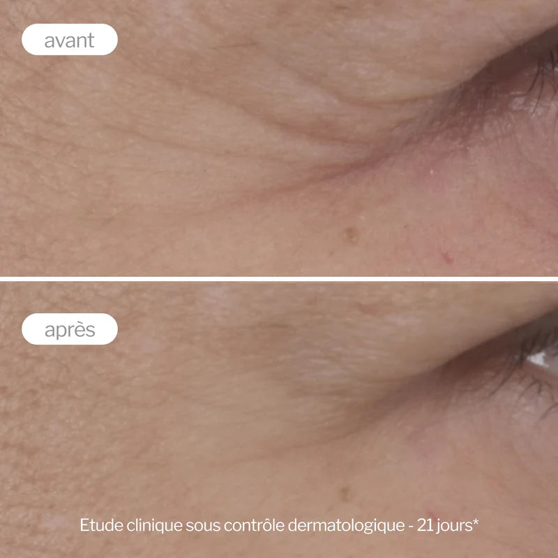 NOVEXPERT Contour Des Yeux Anti-Age Expert 15ml – Soin Contour Yeux Anti-Rides Premium