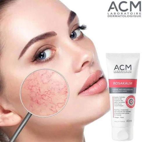 ACM Rosakalm Crème Anti-Rougeurs 40ml Soin Apaisant Rosacée Couperose Peaux Sensibles Réactives Microcirculation