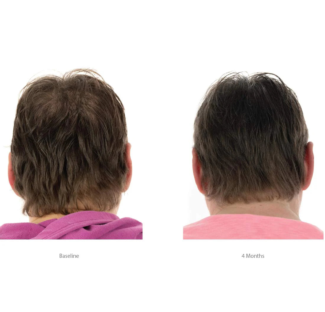 FOLIGAIN Triple Action Shampoing Trioxidil 2% Femme Shampoing Anti-Chute Cheveux Densité Volume Croissance Capillaire