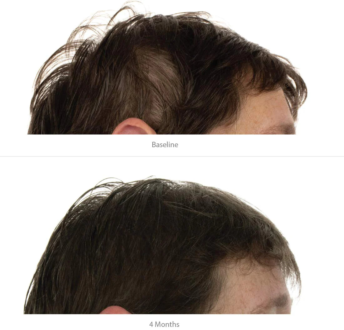 FOLIGAIN Triple Action Shampoing Trioxidil 2% Femme Shampoing Anti-Chute Cheveux Densité Volume Croissance Capillaire
